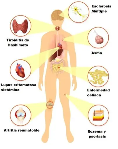 enfermedades autoinmunes